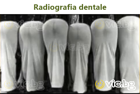 Radiografia dentale