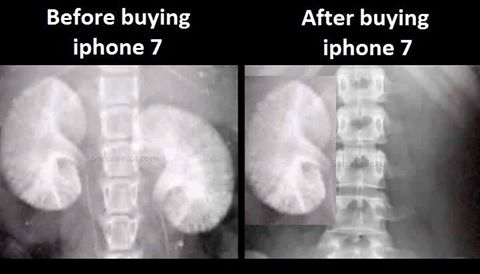 Before and After buying iPhone 7