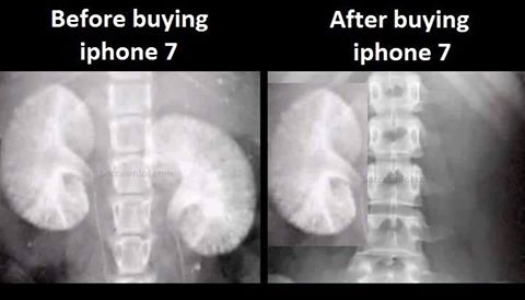 Before and After buying iPhone 7 