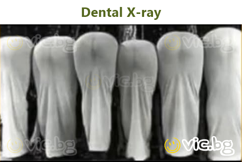 Dental X-ray