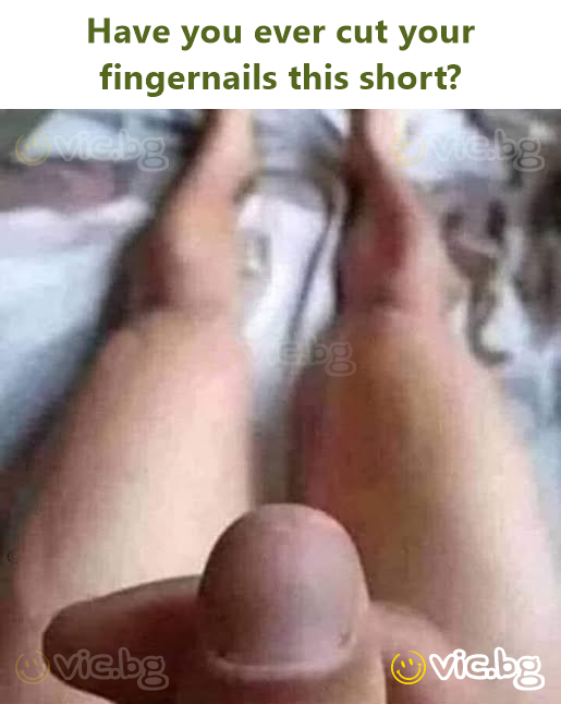 Have you ever cut your fingernails this short?