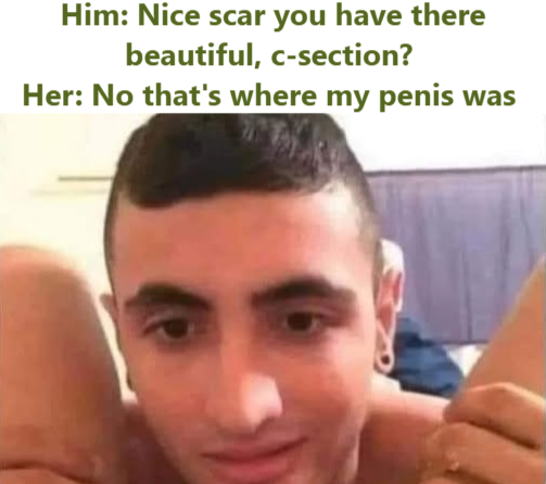 Him: Nice scar you have there beautiful, c-section? Her: No that's where my penis was
