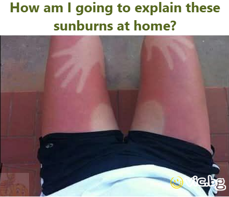 How am | going to explain these sunburns at home?