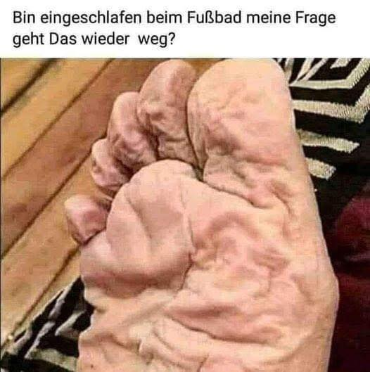 Bin eingeschlafen beim Fußbad meine Frage geht Das wieder weg?