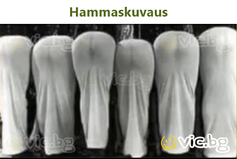 Hammaskuvaus