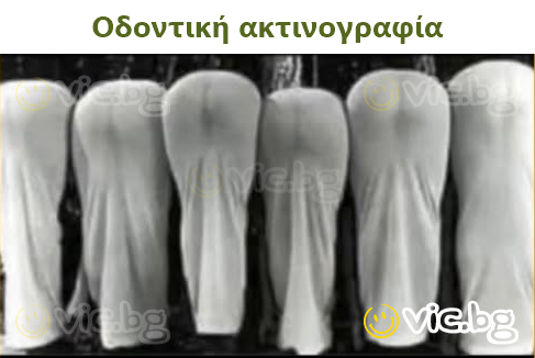 Οδοντική ακτινογραφία