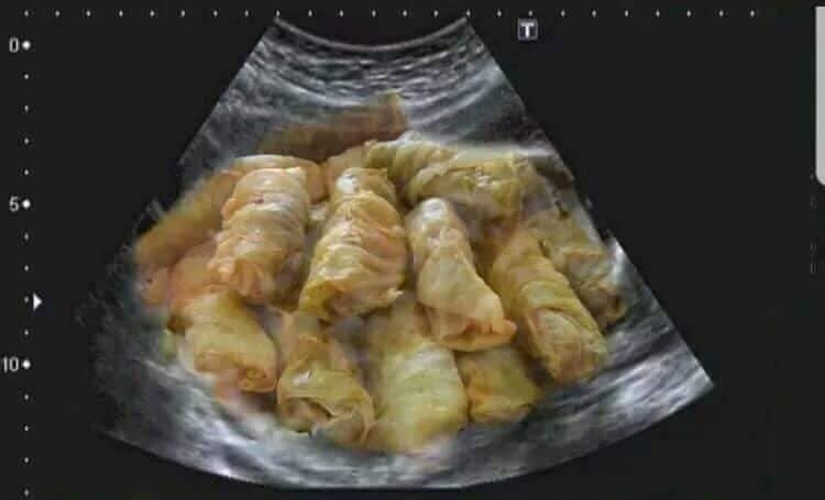 Коледен скенер